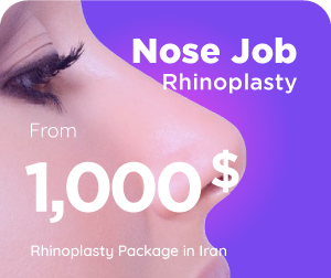 nose job cost in Iran