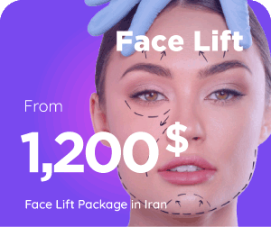 facelift cost in Iran