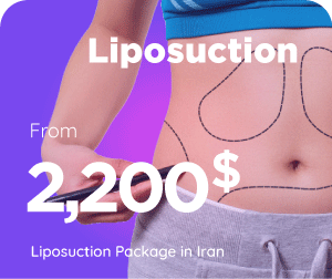 liposuction cost in Iran