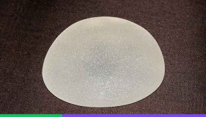 Cohesive Silicone Breast Implant