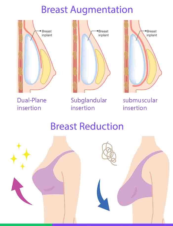 Breast Augmentation VS Breast Reduction