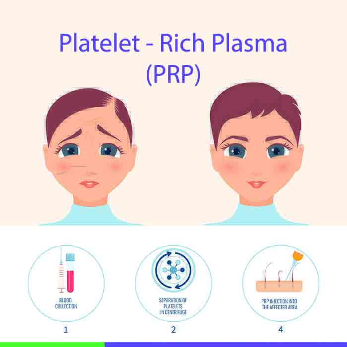 Platelet Rich Plasma (PRP)