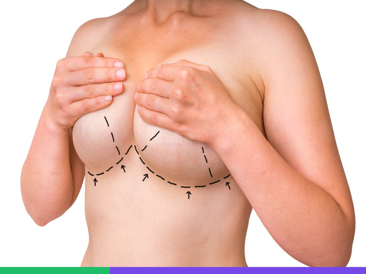 Breast Reduction Surgery option