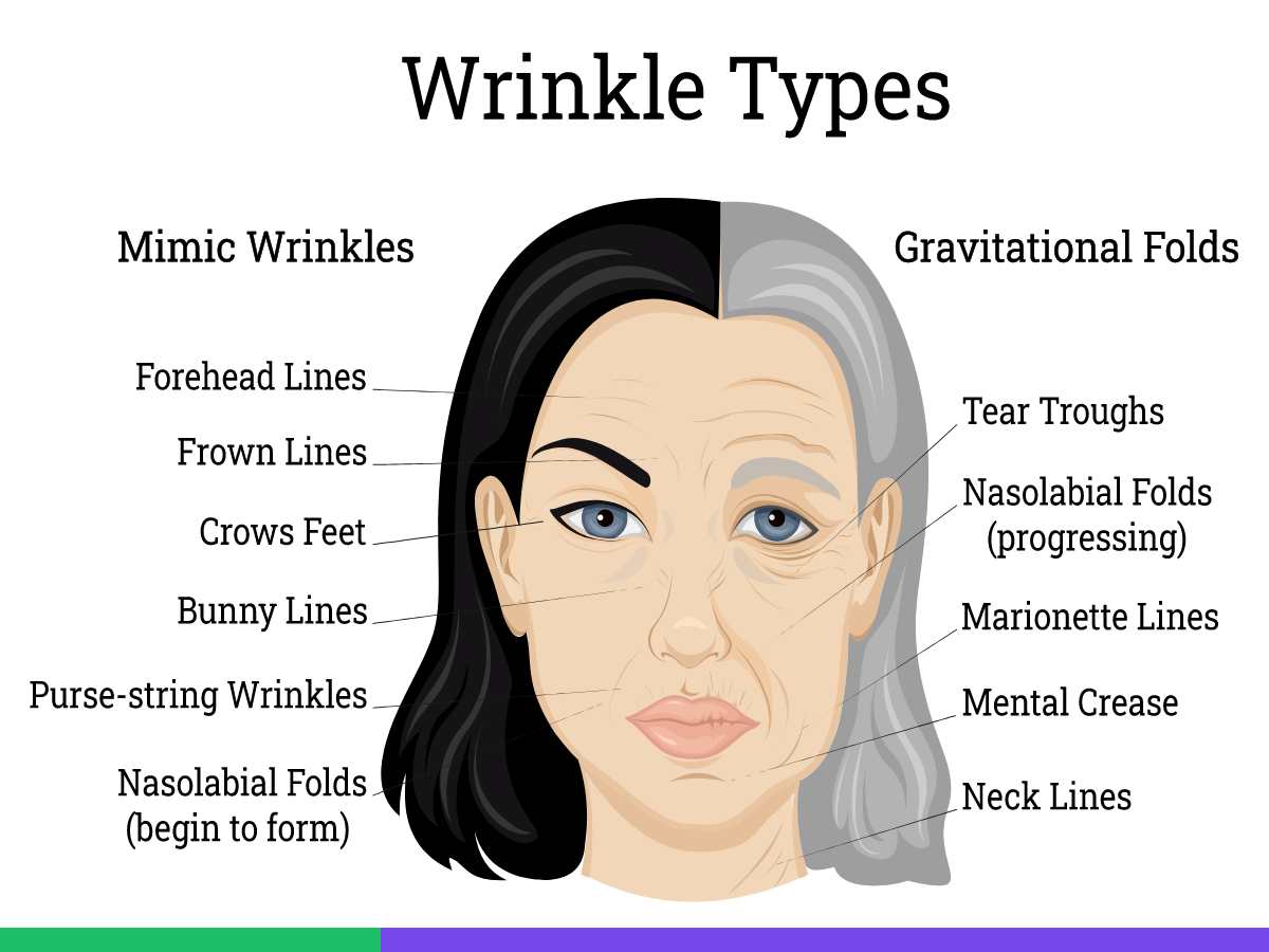 Facelift Surgery Types