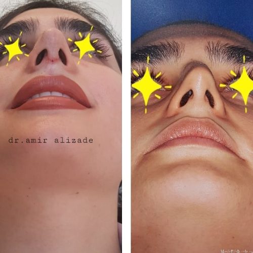 Dr Mohamadamir Alizadeh Tabrizi Elite Oral Surgeon Specialist